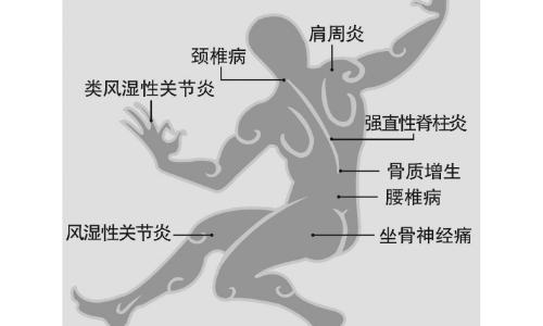 厦门中医风湿骨病特色理疗哪家好|服务项目,采用中医推拿配合祖传特效中药专治人体部位骨质增生,腰椎间盘突出,风湿类湿病,中风半身不遂,风湿关节炎,腰肌劳损,筋骨痛,颈椎病,手腿麻木,强直脊椎炎,痛风,厦门禾祥西路古龙商城二楼686之5,联系方式13860488263苏女士